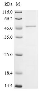Recombinant Human G-protein coupled receptor 182 (GPR182)