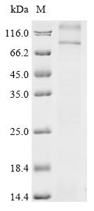 Recombinant Rat Thyrotropin receptor (Tshr)