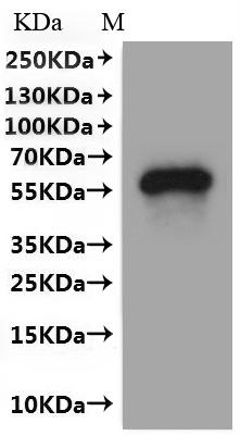 Recombinant Human Transmembrane 9 superfamily member 1 (TM9SF1)-VLPs