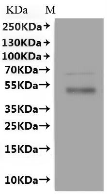 Recombinant Human Monocarboxylate transporter 6 (SLC16A5)-VLPs