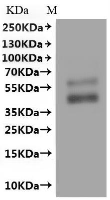 Recombinant Human Beta-1 adrenergic receptor (ADRB1)-VLPs
