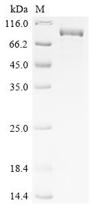 Recombinant Human Terminal nucleotidyltransferase 5C (TENT5C)