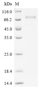 Recombinant Human Desmoglein-1 (DSG1), partial