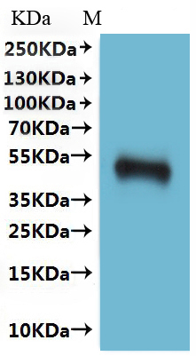 Recombinant Human C-C chemokine receptor type 5 (CCR5)-VLPs (Active)