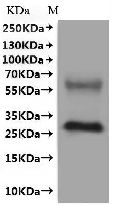 Recombinant Human Olfactory receptor 51E2 (OR51E2)-VLPs