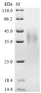 Recombinant Human V-type immunoglobulin domain-containing suppressor of T-cell activation (VSIR), partial, Biotinylated
