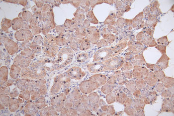 UCP1 Antibody