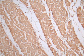 UCP1 Antibody