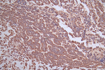 UCP1 Antibody