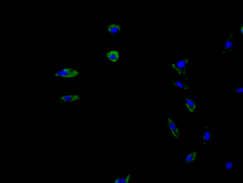 UCP1 Antibody