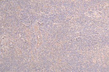 LAG3 Antibody