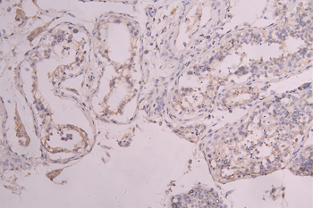 KIT Antibody