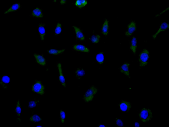 SLC1A5 Antibody