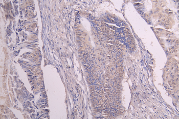 GREM1 Antibody
