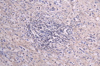 GREM1 Antibody