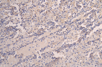 KDR Antibody