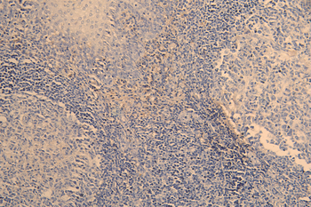 TNFRSF4 Antibody