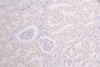 SOST Antibody