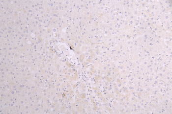 SOST Antibody