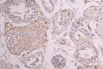 CSF3R Antibody