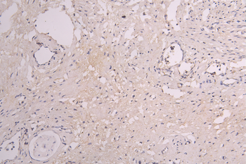 CSF3R Antibody