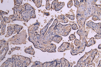 ACVR2A&ACVR2B Antibody