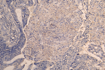 ACVR2A&ACVR2B Antibody