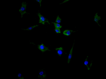 ACVR2A&ACVR2B Antibody