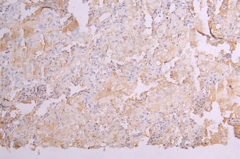 KIR2DL1 Antibody