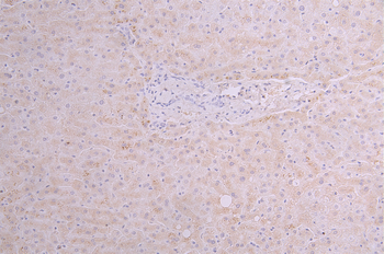 TSLP Antibody