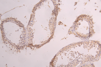 APP Antibody