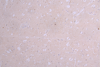 APP Antibody