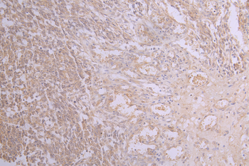 APP Antibody