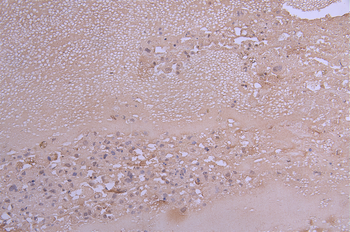 CCL2 Antibody