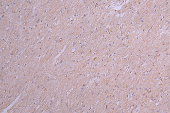 IL22 Antibody
