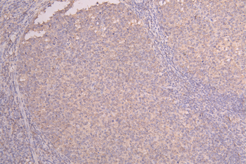 IL22 Antibody