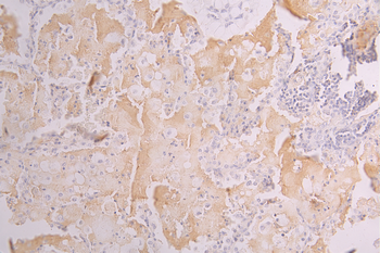 AOC3 Antibody