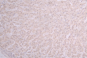 AOC3 Antibody
