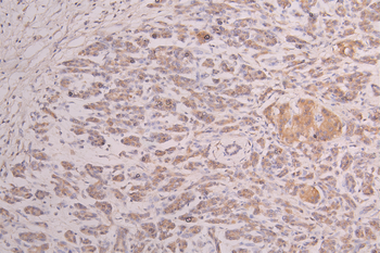 IGF1 Antibody