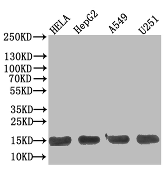 TNFRSF10B Antibody