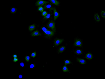 TNFRSF10B Antibody