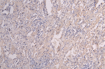 IFNB1 Antibody