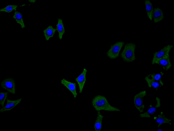 CSF2RB Antibody