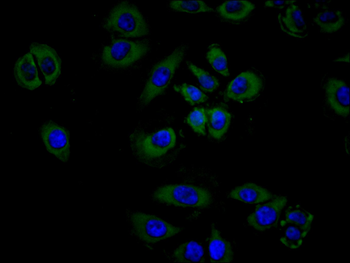 CSF2RB Antibody