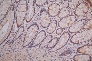 SYP Antibody