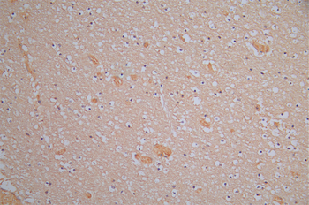 DPYSL2 Antibody