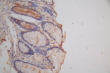 DPYSL2 Antibody