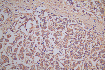 DPYSL2 Antibody