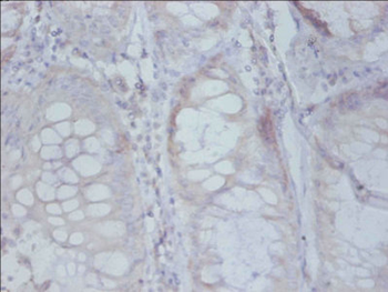 RPS19 Antibody