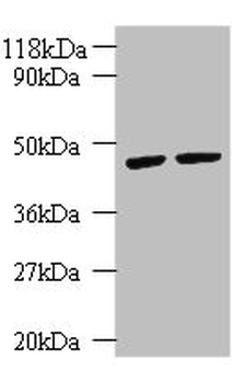 KRT18 Antibody